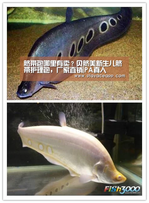 脐带包哪里有卖?贝脐美新生儿脐带护理包,厂家直销|PA真人(图2) PA真人