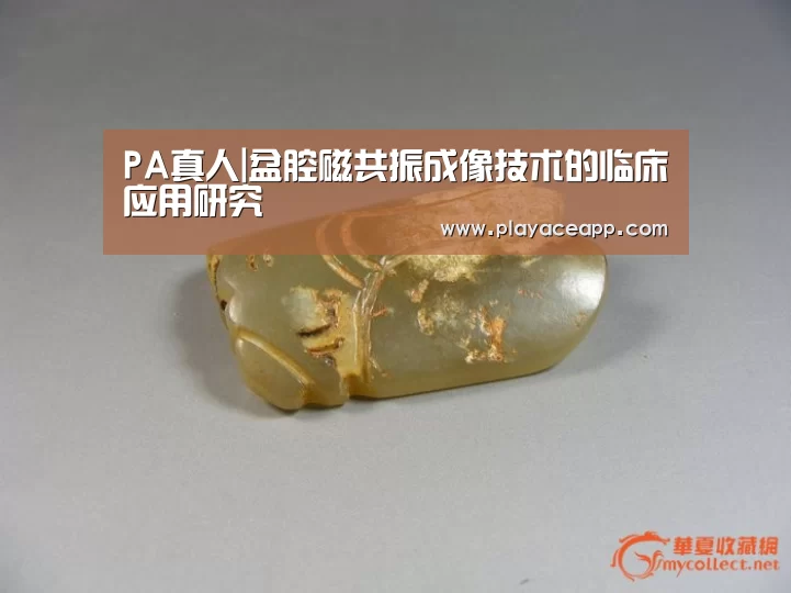 PA真人|盆腔磁共振成像技术的临床应用研究(图4) PA真人集团